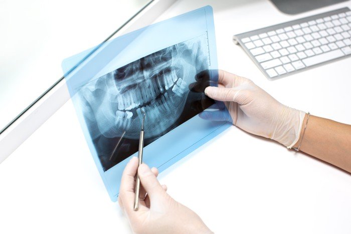 Best Digital X-Ray Services in Awas Vikash Colony Agra