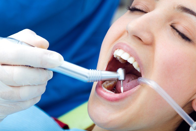 Best Scaling And Polishing Dental Treatment in Awas Vikas Colony Agra