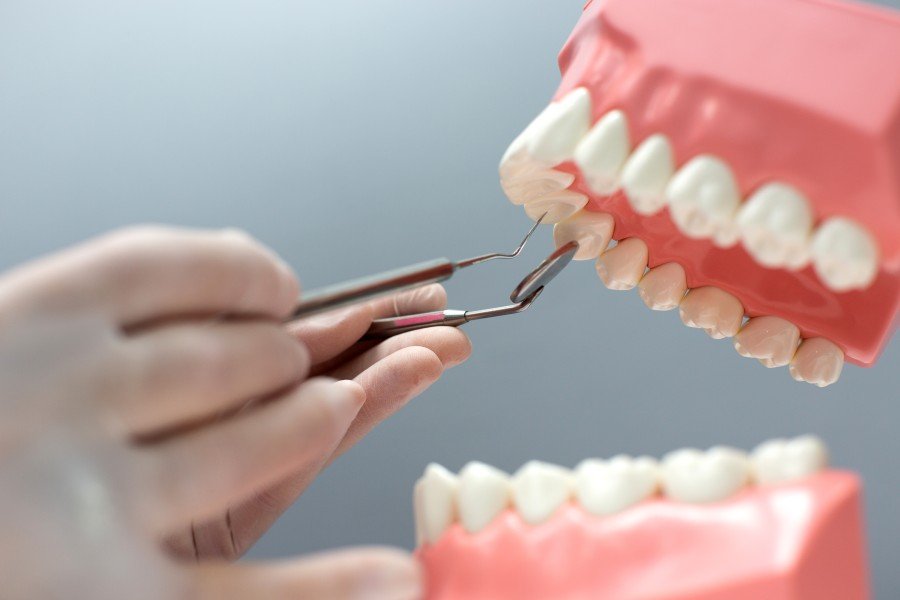 Best Permanent Teeth Replacement Clinic in Agra