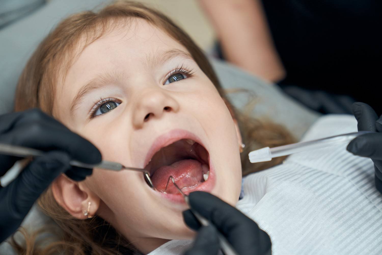 Child Dental Care in Awas Vikas Colony Agra