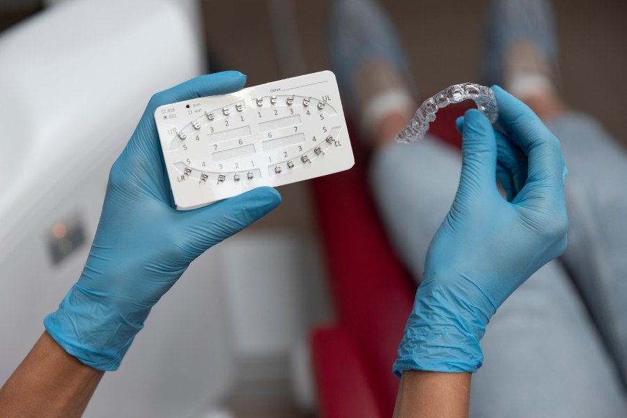 Dentist holding an orthodontic bracket placement guide and a clear dental aligner in blue-gloved hands.
