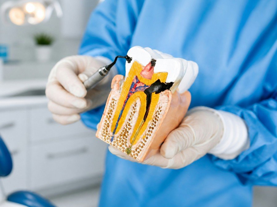 Dentist holding a tooth cross-section model and dental instrument during a demonstration